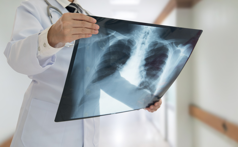 What the Future Holds for X-Rays | create jobs 51/Shutterstock