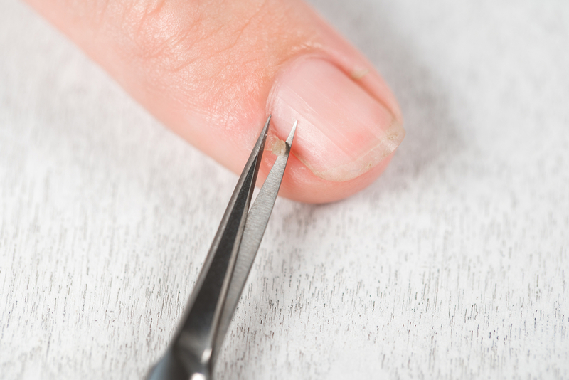 Deal With Hangnails | Shutterstock